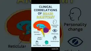 Mastering Brain Anatomy: From Structure to Clinical Insight | MedScope360