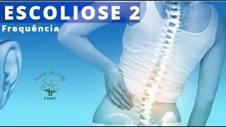 ESCOLIOSE (COLUNA TORTA) Frequ&ecirc;ncia para corre&ccedil;&atilde;o da escoliose Ondas sonoras Canal fonte de Vida