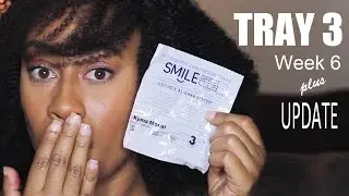 WK 6 (Clear Braces): Tray 2 Update + Tray 3 Try-on | SmileDirectClub | Kyma Monai