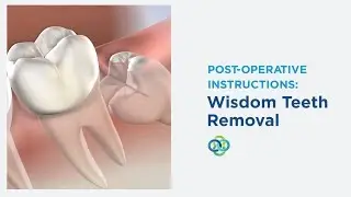 Post-Op Instructions: Wisdom Teeth Removal in Honolulu, HI, and Aiea, HI | Oral Surgery Hawaii