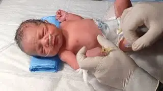 NICU IV Cannulation Procedure. How to Insert IV Catheter & Calculate Injection Dose (Step-by-Step)❣️