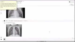 covid 19 detection using xrays with machine learning