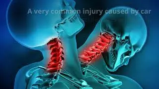 Car Accident Injuries And Symptoms: What To Expect | Tebby Clinic | 704-541-7111