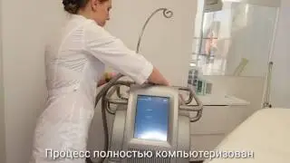 Криолиполиз ZELTIQ: удаление 