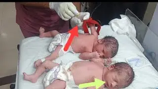 Newborn Twin Babies: Two IV Lines Placement & Medication Administration | NICU Care