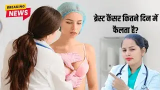 Breast Cancer कितने दिन में फैलता है? | How Fast Does Breast Cancer Spread? Complete Medical Guide