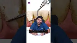 Decoding the benefits of scaling |  Siri Dental Hospital | Best Dental Clinic | Invisalign Hyderabad