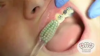 Orthodontic Home Care Instructions- Cureton Ortho