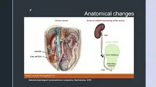 Renal Disease in Pregnancy