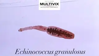 Trabalho de Parasitologia Veterin&aacute;ria - Echinococcus Granulosus