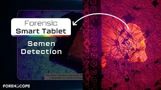 FORENSIC SMART TABLET SMART BUTTON FUNCTION