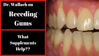 Dr  Wallach on Receding Gums