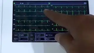 Cara Menggunakan Contec EKG 600G | Demo Online Alat Kesehatan