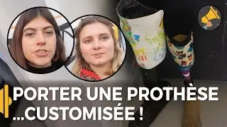 MA VIE AVEC UNE PROTHÈSE... CUSTOMISÉE ! / Enora et Léa en France