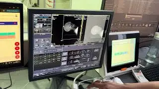 Angio cerebral
