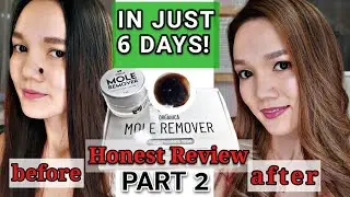 Organica Mole Remover|Honest Review Part 2