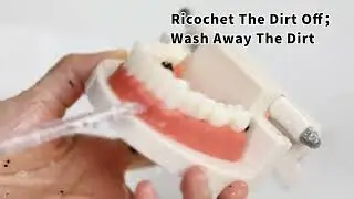 Large gaps between teeth prone to getting stuck? Hard to clean braces? None of this is a problem