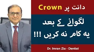Dental Crown Procedure In Urdu/Hindi - Teeth Crowning - Must watch before dental work - Dr.Imran Zia