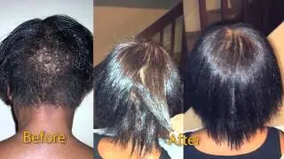 One Year After My Big Chop