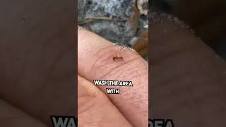How to survive an ant attack #survival #medical #school
