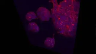 LNCAP reconstruction.avi