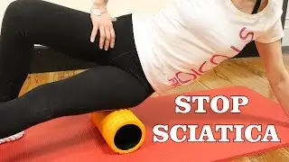 Stop alla Sciatica col trattamento dei Trigger Point