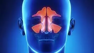 Balloon Sinuplasty Explained - Dr. Ryan M. Kauffman - Northwest ENT