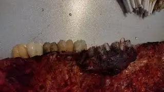 Bio zombie costume preparation pt. 3 teeth. #tutorial #diy #howto #halloween #zombie #costume