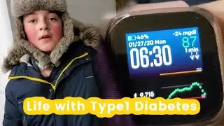 Day in the Life | Type 1 Diabetes