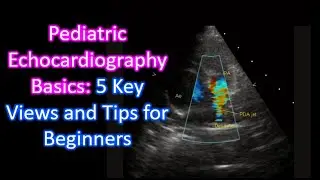 Pediatric Echocardiography Basics: 5 Key Views and Tips for Beginners