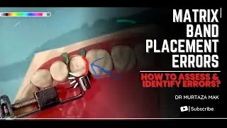 Matrix band placement Errors