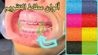 مطاط التقويم { كيف ؟ متى ؟ لماذا ؟ } #dr_eslam_nabil #teeth #dentist #braces #comedy #تقويم