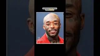 Rappers If they were Bald 😱😱🤭🤭😂😂
