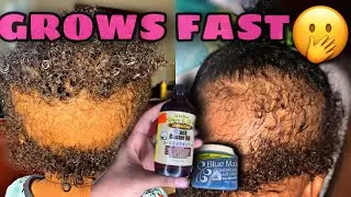 How To Grow Baby Bald Spot ( fast less than 30 days ) 🤭