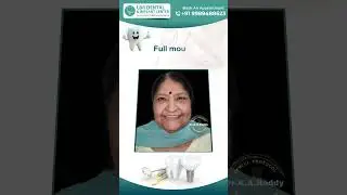 5 LIFE-CHANGING Benefits of Full Mouth Rehabilitation You Need to Know! Best Dental Clinic