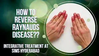 How to Reverse Raynaud&rsquo;s Disease ? Integrative Treatment at SIMS Hyderabad.