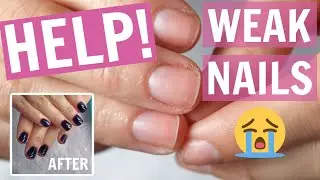 РЕАБИЛИТАЦИЯ ПОСЛЕ ГЕЛЯ! | ТОВАРЫ WALMART