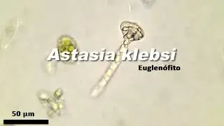 Astasia klebsi (Euglen&oacute;fito)
