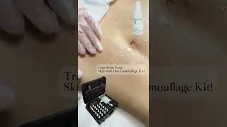 Skin Camouflage