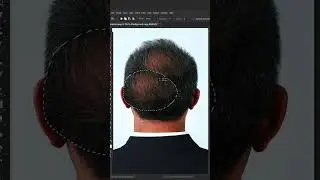 Fix baldness using Photoshop