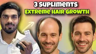 3 Amazing Supplements for hair growth (Hair fall, Grey hair, Dandruff, || How to grow hair