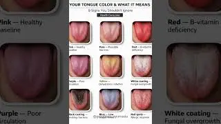 Your Tongue 👅 Color & What It Means | 9 Health Signs You Shouldn&rsquo;t  Ignore#tonguehealth #gurubhau