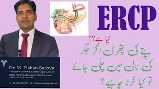What is ERCP? Treatment for Bile Duct/CBD Stones!