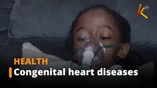 Congenital heart diseases common forms of birth defects