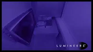 Denmat Lab 4