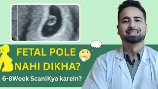 FETAL pole Not seen at 6&ndash;8 WEEKS? Doctor&rsquo;s Honest Advice | Kya KAREIN?