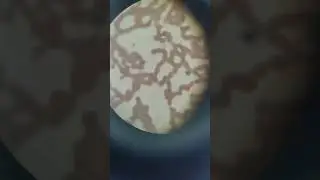 Mono, neutrophils, poly, count #bloodcount #microscope #viral #shorts