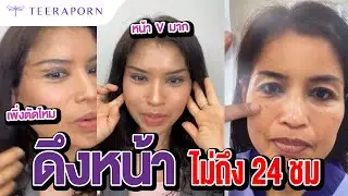 หลังทำไม่ถึง 24 ชั่วโมง ศัลยกรรมดึงหน้า FACE-LOCK FACELIFT  ธีรพรคลินิก หมอชลธิศ