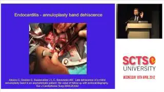 Paravalvular leak transoesophageal echocardiography