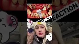 Dentist Reacts while in Istanbul: moving implants? #shorts #viral #teeth #short #istanbul